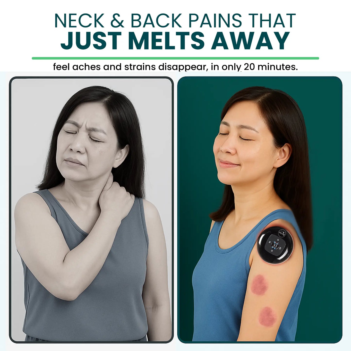 [REVIA] Smart Cupping PRO, Red-Light Therapy & Dynamic Suction
